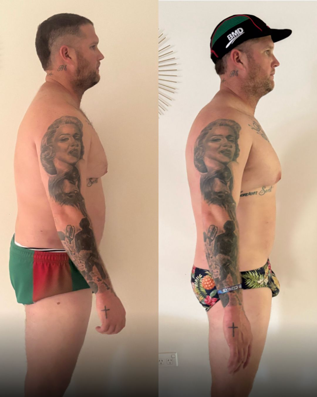 James transformation 2